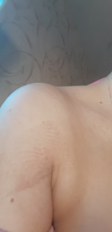 Кинезиотейп Kinexib Pro tape, бежевый, отзывы покупателей, фото 1