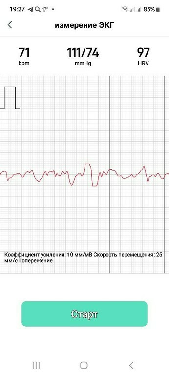 undefined, отзывы покупателей, фото 3