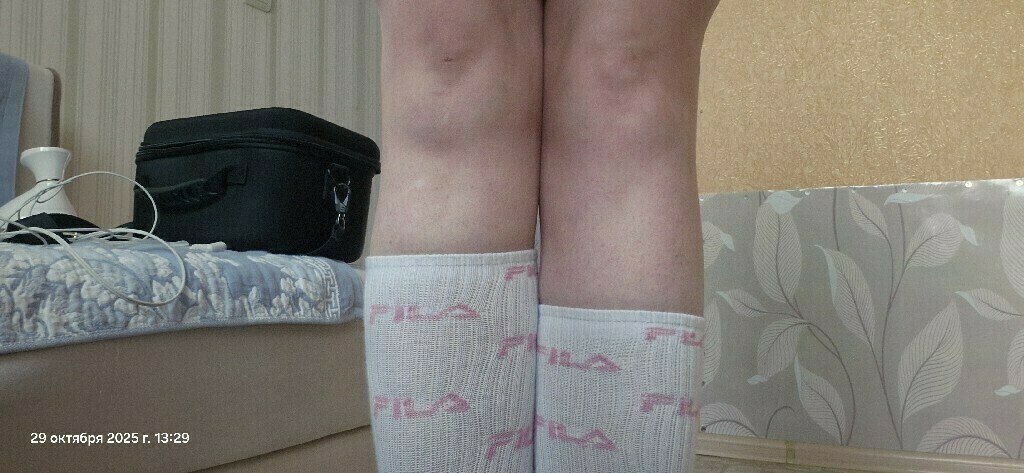 undefined, отзывы покупателей, фото 2