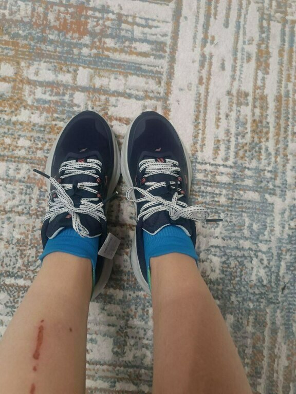 undefined, отзывы покупателей, фото 2